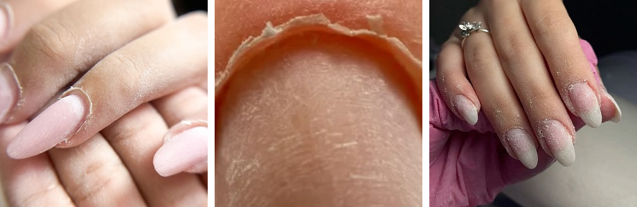 How to care for cuticles
